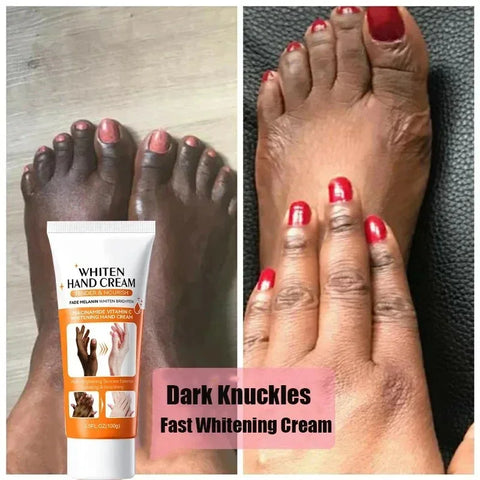 DivaBlush™ Dark Knuckles Fast Brightening Serum Hand Anti Cracking Cream Fingers Brighten Moisturiz For Dark Skin Stains Remover Products