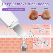 DivaBlush™ Electric Ultrasonic Skin Scrubber – Blackhead Remover & Facial Lifting Tool