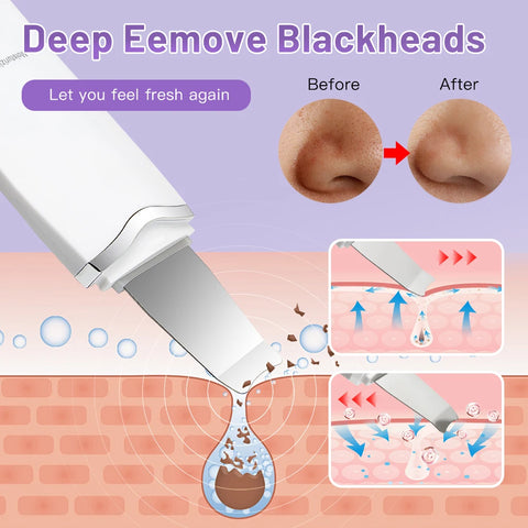 DivaBlush™ Electric Ultrasonic Skin Scrubber – Blackhead Remover & Facial Lifting Tool