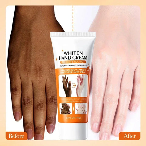 DivaBlush™ Dark Knuckles Fast Brightening Serum Hand Anti Cracking Cream Fingers Brighten Moisturiz For Dark Skin Stains Remover Products